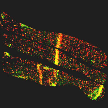 mouse cardiac muscle