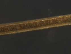 dog hair (dark field)