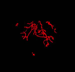 blood vessls in a mouse solid tumor