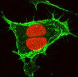 fluorescently labeled nuclei and plasma membranes
